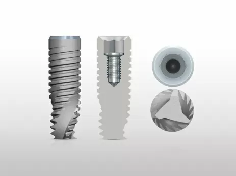 Имплант OSSTEM + циркониевая коронка