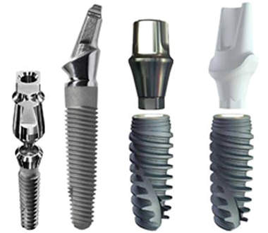 Различные виды зубных имплантатов Виды зубных имплантов