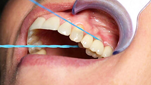 Зубная нить