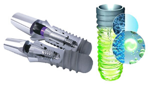 Заграничные импланты