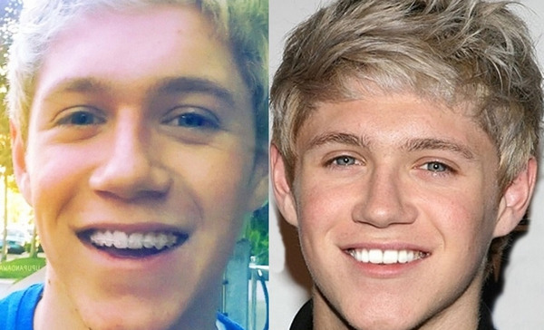 Неправильный прикус